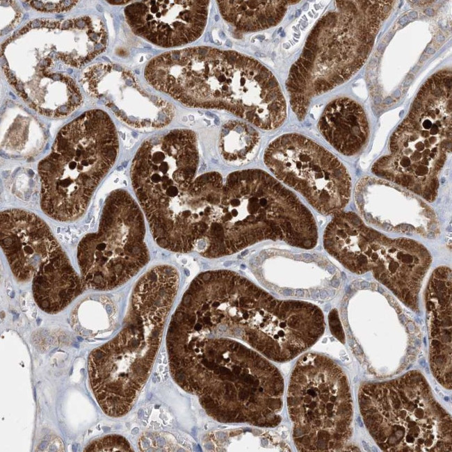 ECHDC1 Antibody in Immunohistochemistry (Paraffin) (IHC (P))