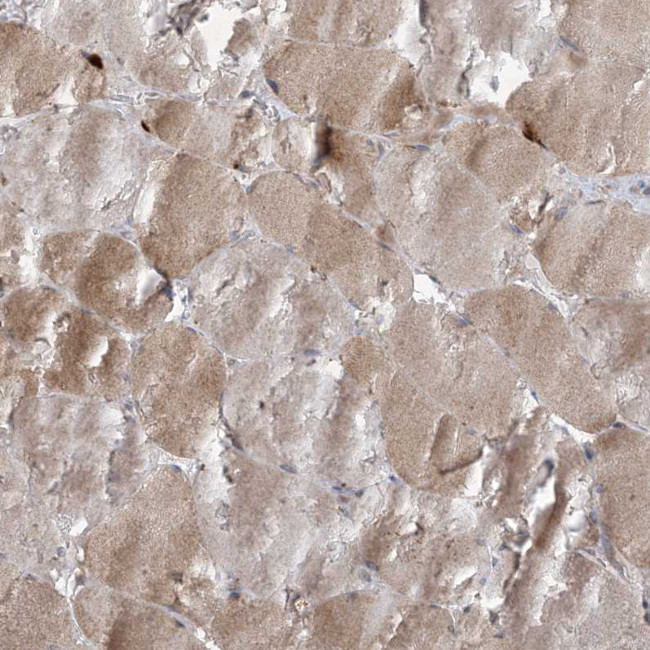MRPS18A Antibody in Immunohistochemistry (Paraffin) (IHC (P))