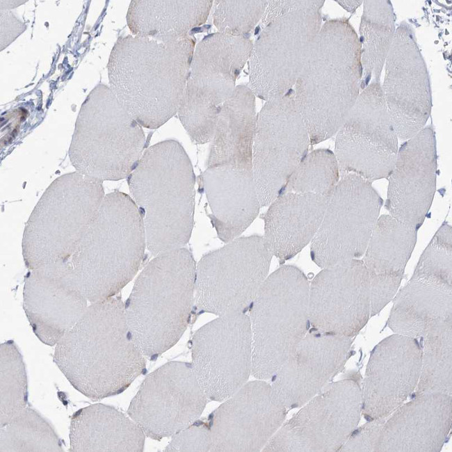 ANKRD35 Antibody in Immunohistochemistry (Paraffin) (IHC (P))