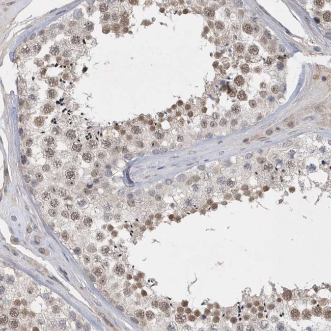 FAM217A Antibody in Immunohistochemistry (Paraffin) (IHC (P))