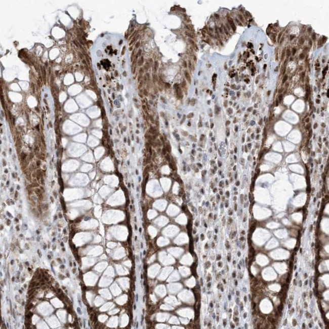 ECT2L Antibody in Immunohistochemistry (Paraffin) (IHC (P))