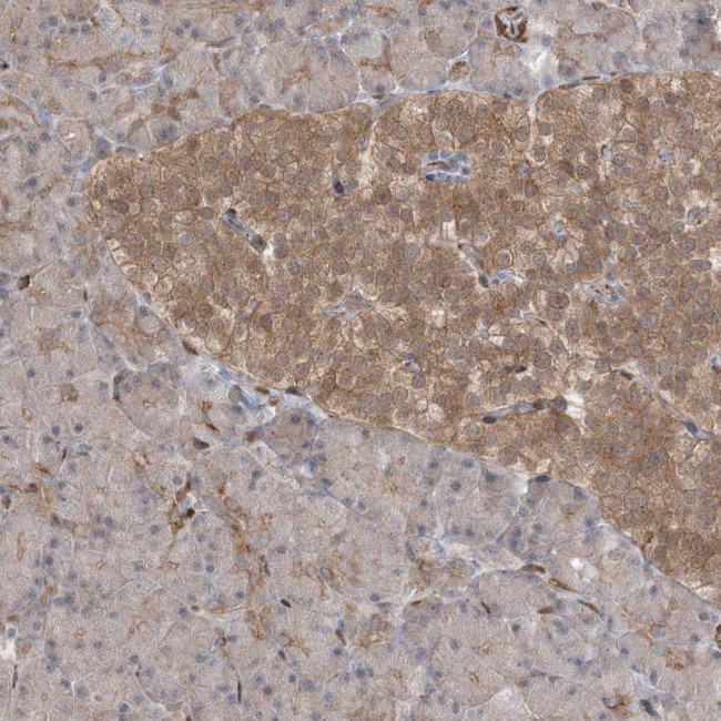 RIN1 Antibody in Immunohistochemistry (Paraffin) (IHC (P))