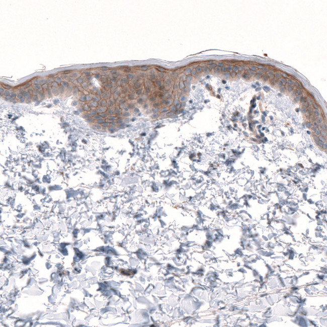 LRRC15 Antibody in Immunohistochemistry (IHC)