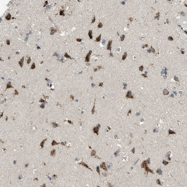 GPR111 Antibody in Immunohistochemistry (Paraffin) (IHC (P))