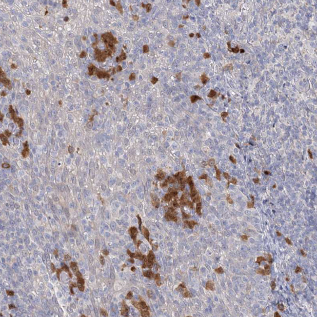 GMPPA Antibody in Immunohistochemistry (IHC)
