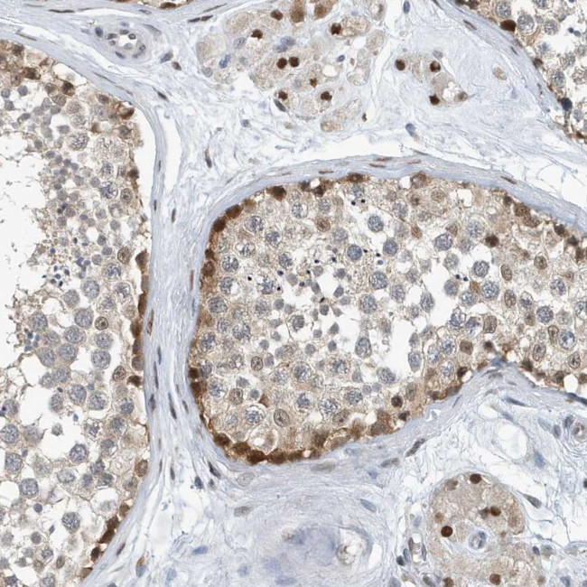 KIF15 Antibody in Immunohistochemistry (Paraffin) (IHC (P))