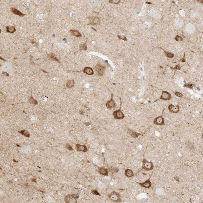 KSR2 Antibody in Immunohistochemistry (Paraffin) (IHC (P))