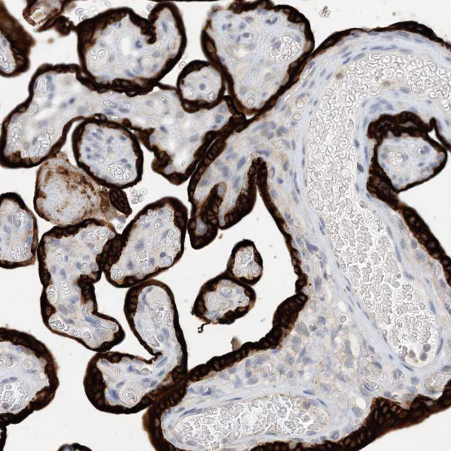 KBP Antibody in Immunohistochemistry (Paraffin) (IHC (P))