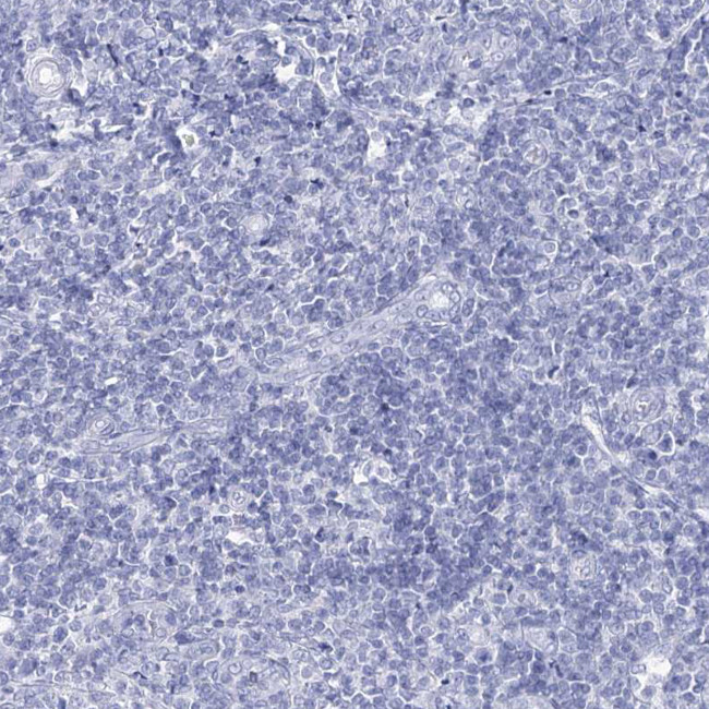 RNF186 Antibody in Immunohistochemistry (Paraffin) (IHC (P))