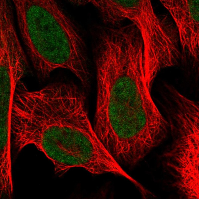 CGGBP1 Antibody in Immunocytochemistry (ICC/IF)