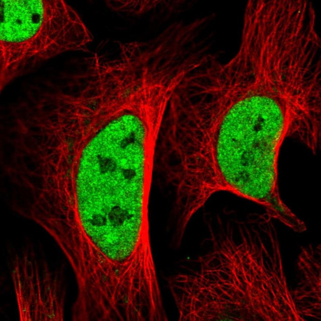 SETD5 Antibody in Immunocytochemistry (ICC/IF)