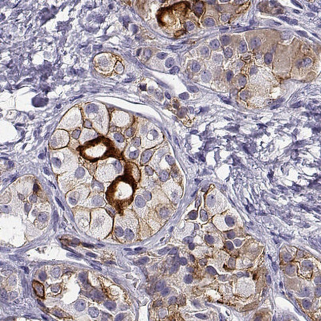 IGSF1 Antibody in Immunohistochemistry (IHC)