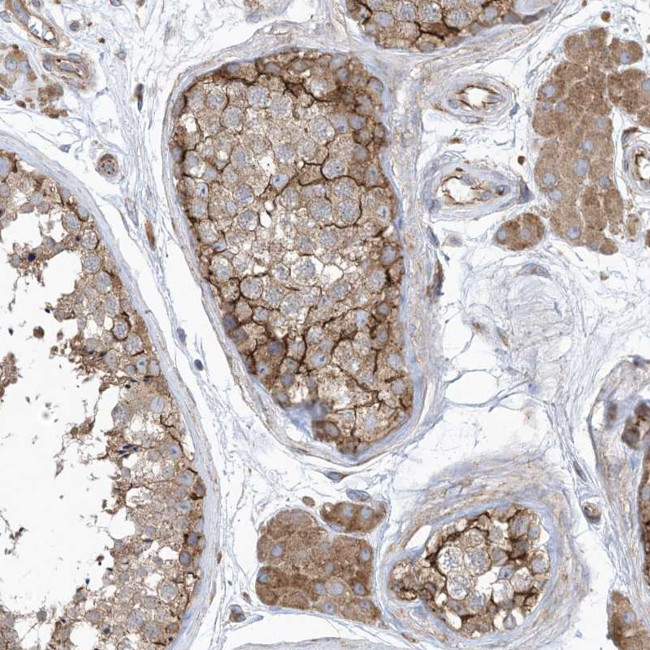 OTOP1 Antibody in Immunohistochemistry (Paraffin) (IHC (P))
