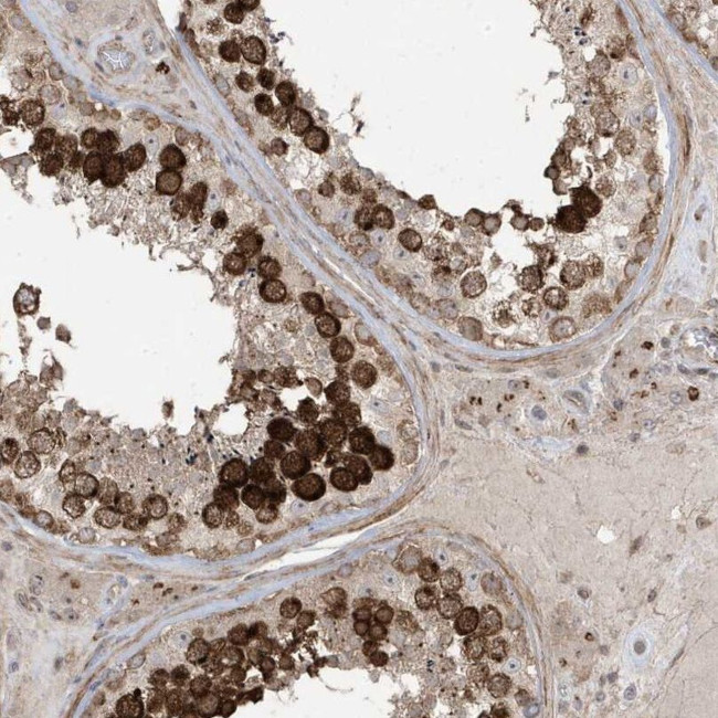 Centrin 3 Antibody in Immunohistochemistry (IHC)