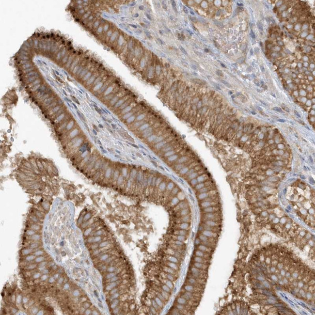 CNOT10 Antibody in Immunohistochemistry (Paraffin) (IHC (P))