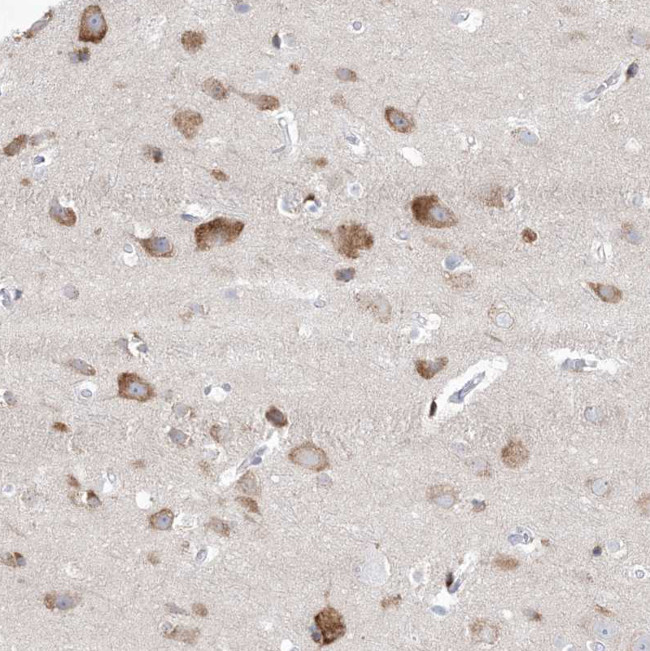 GABRG1 Antibody in Immunohistochemistry (Paraffin) (IHC (P))