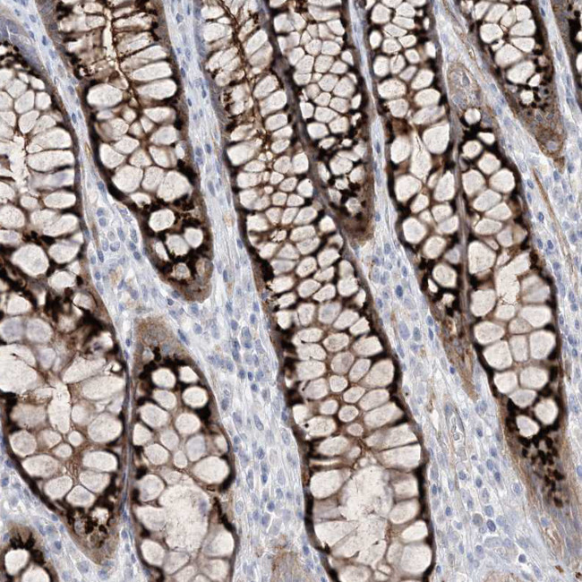 B3GNT7 Antibody in Immunohistochemistry (Paraffin) (IHC (P))