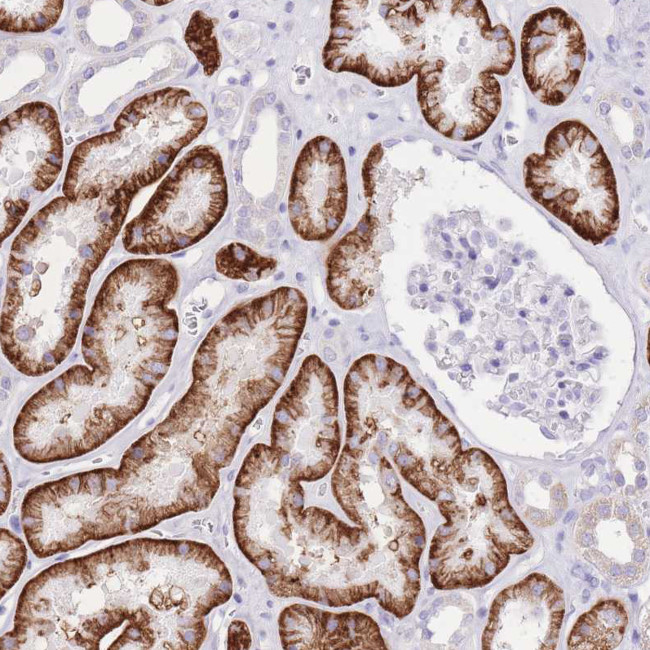 SLC4A4 Antibody in Immunohistochemistry (Paraffin) (IHC (P))