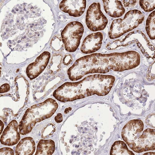 SLC4A4 Antibody in Immunohistochemistry (Paraffin) (IHC (P))