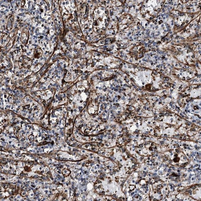 DPEP2 Antibody in Immunohistochemistry (IHC)