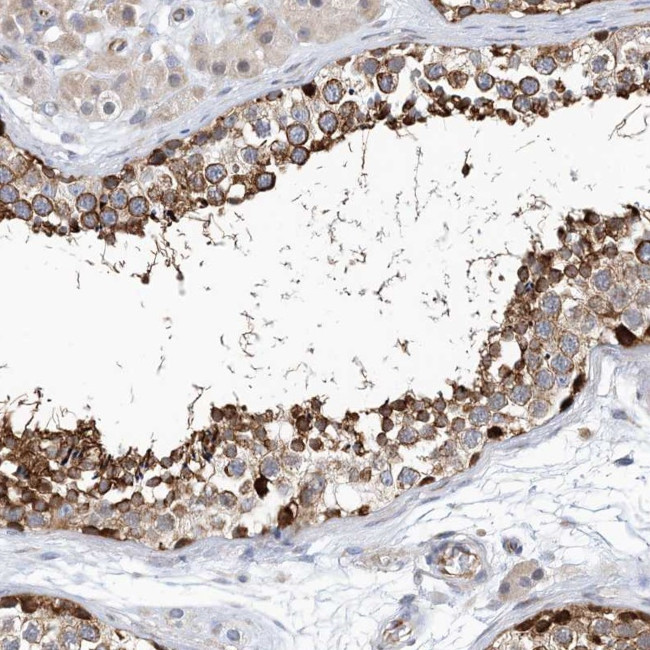PCDHA2 Antibody in Immunohistochemistry (Paraffin) (IHC (P))