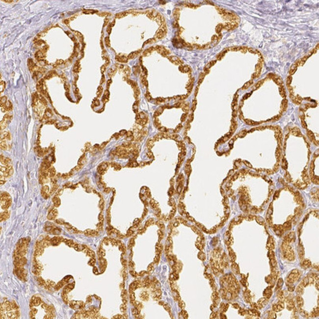 CSN1S1 Antibody in Immunohistochemistry (IHC)