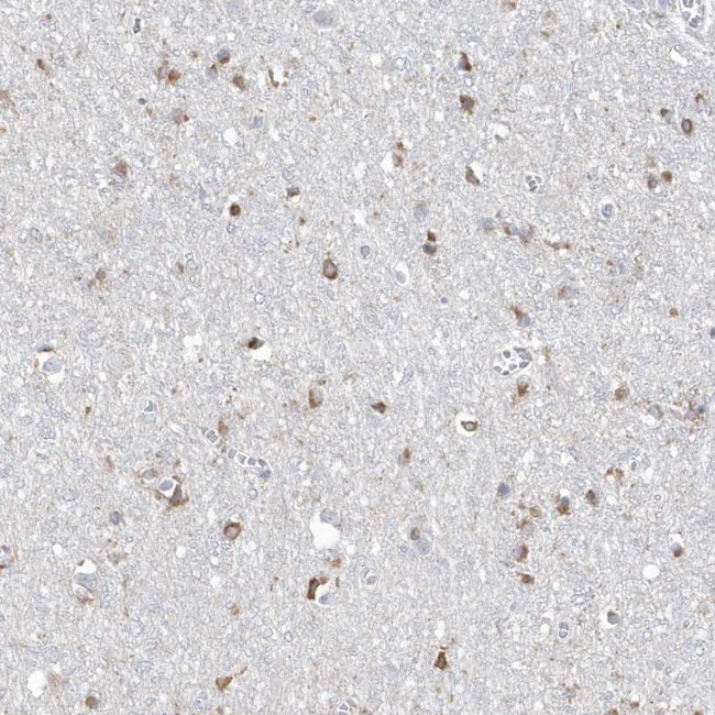 TMEM132B Antibody in Immunohistochemistry (Paraffin) (IHC (P))