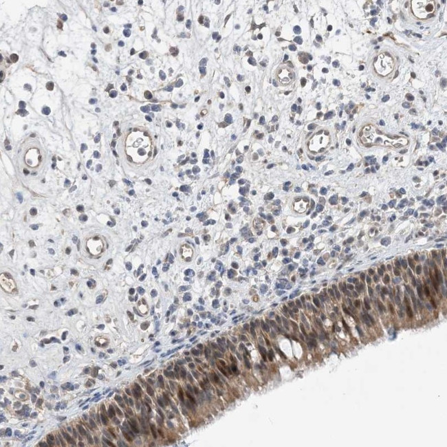TMEM132B Antibody in Immunohistochemistry (Paraffin) (IHC (P))