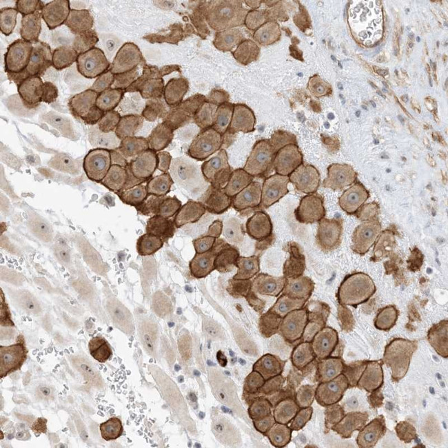 IL36B Antibody in Immunohistochemistry (Paraffin) (IHC (P))