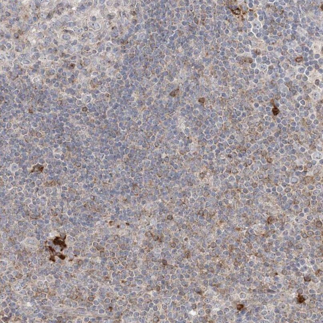 CLNK Antibody in Immunohistochemistry (IHC)