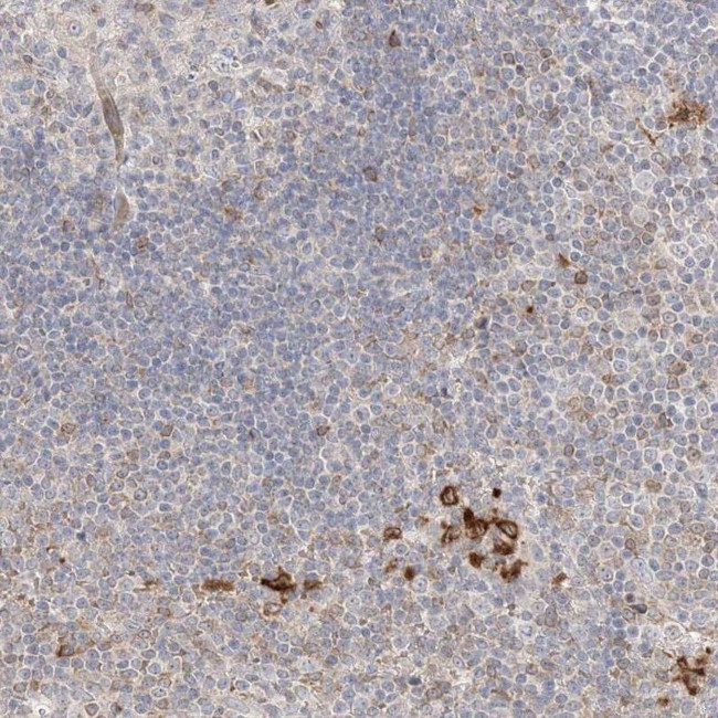 CLNK Antibody in Immunohistochemistry (IHC)