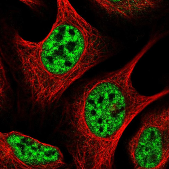 AP5Z1 Antibody in Immunocytochemistry (ICC/IF)