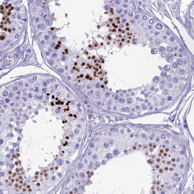 HMGB4 Antibody in Immunohistochemistry (Paraffin) (IHC (P))
