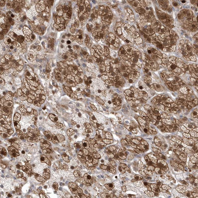 Gemin 6 Antibody in Immunohistochemistry (Paraffin) (IHC (P))