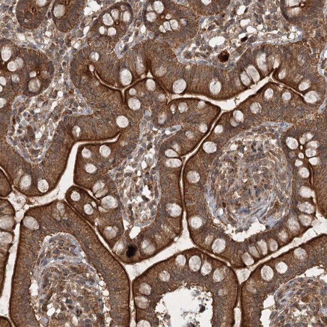 UNC93A Antibody in Immunohistochemistry (Paraffin) (IHC (P))