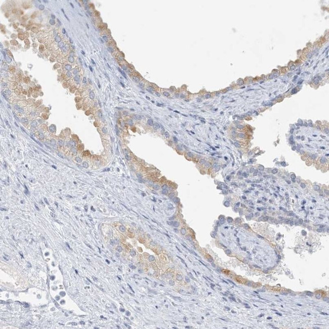 ANO7 Antibody in Immunohistochemistry (IHC)