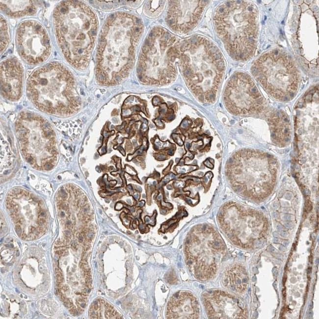 ZNF16 Antibody in Immunohistochemistry (Paraffin) (IHC (P))