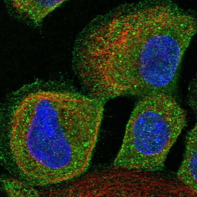 ALS2CR12 Antibody in Immunocytochemistry (ICC/IF)