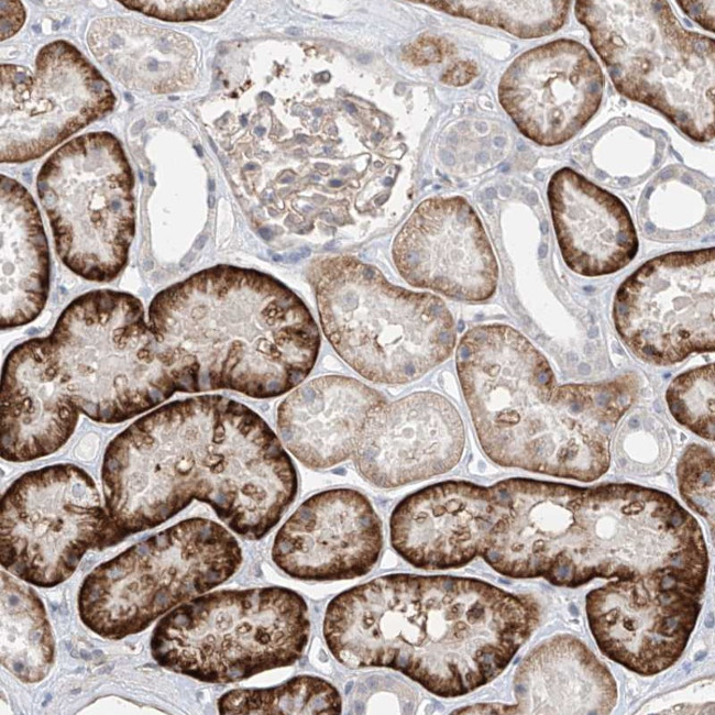 ABLIM2 Antibody in Immunohistochemistry (Paraffin) (IHC (P))