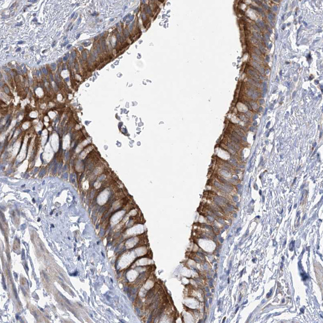 CLEC16A Antibody in Immunohistochemistry (Paraffin) (IHC (P))