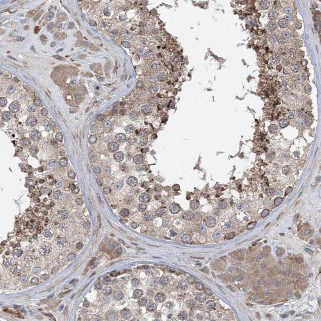 CLEC16A Antibody in Immunohistochemistry (IHC)