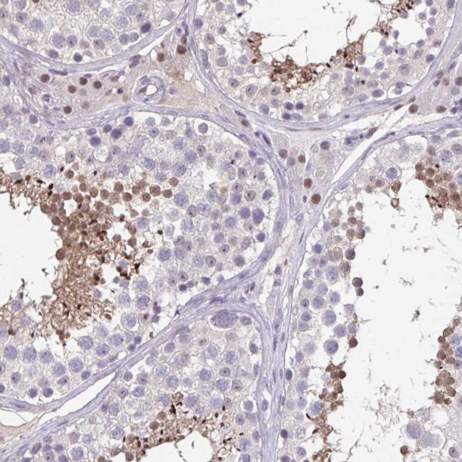 ACTRT3 Antibody in Immunohistochemistry (Paraffin) (IHC (P))