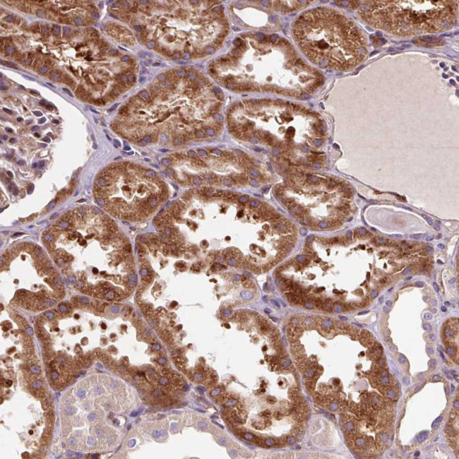 PCDHGB3 Antibody in Immunohistochemistry (Paraffin) (IHC (P))