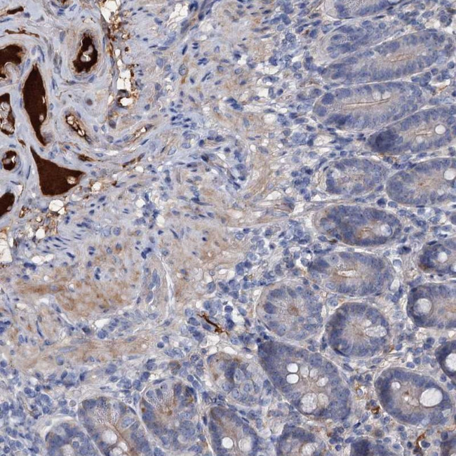 Chordin Antibody in Immunohistochemistry (Paraffin) (IHC (P))