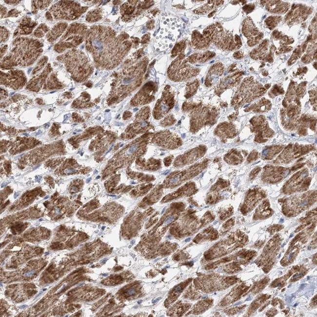 PPP2R3A Antibody in Immunohistochemistry (Paraffin) (IHC (P))