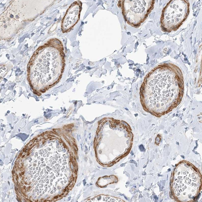 GTF3C2 Antibody in Immunohistochemistry (Paraffin) (IHC (P))