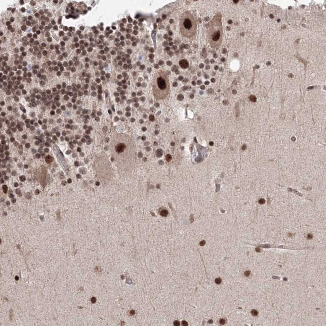 C4orf14 Antibody in Immunohistochemistry (Paraffin) (IHC (P))