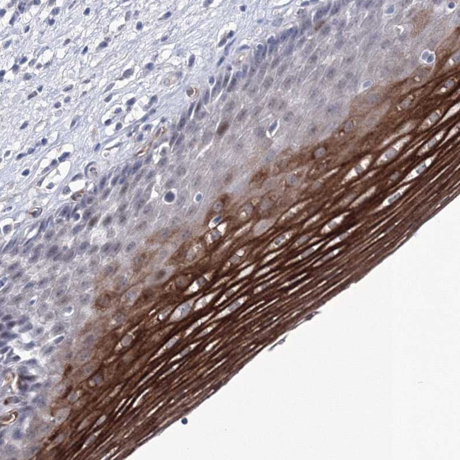 ACOX3 Antibody in Immunohistochemistry (Paraffin) (IHC (P))