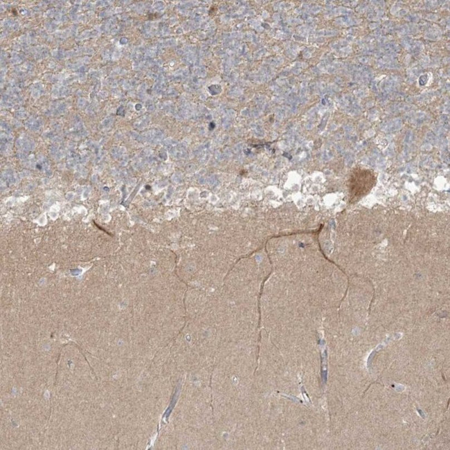 TRIM2 Antibody in Immunohistochemistry (IHC)