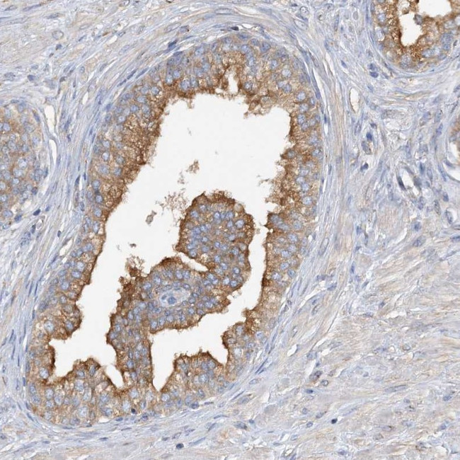 SIDT1 Antibody in Immunohistochemistry (Paraffin) (IHC (P))